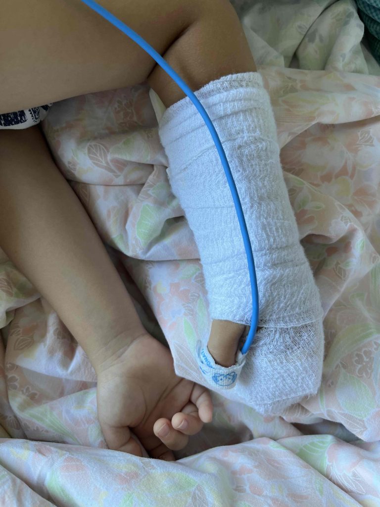体調を崩し、布団の上で静かに休んでいる子どもの腕。点滴のチューブが包帯で固定されている様子。